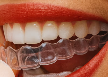 Was macht DrSmile aus und wie funktioniert der Service?